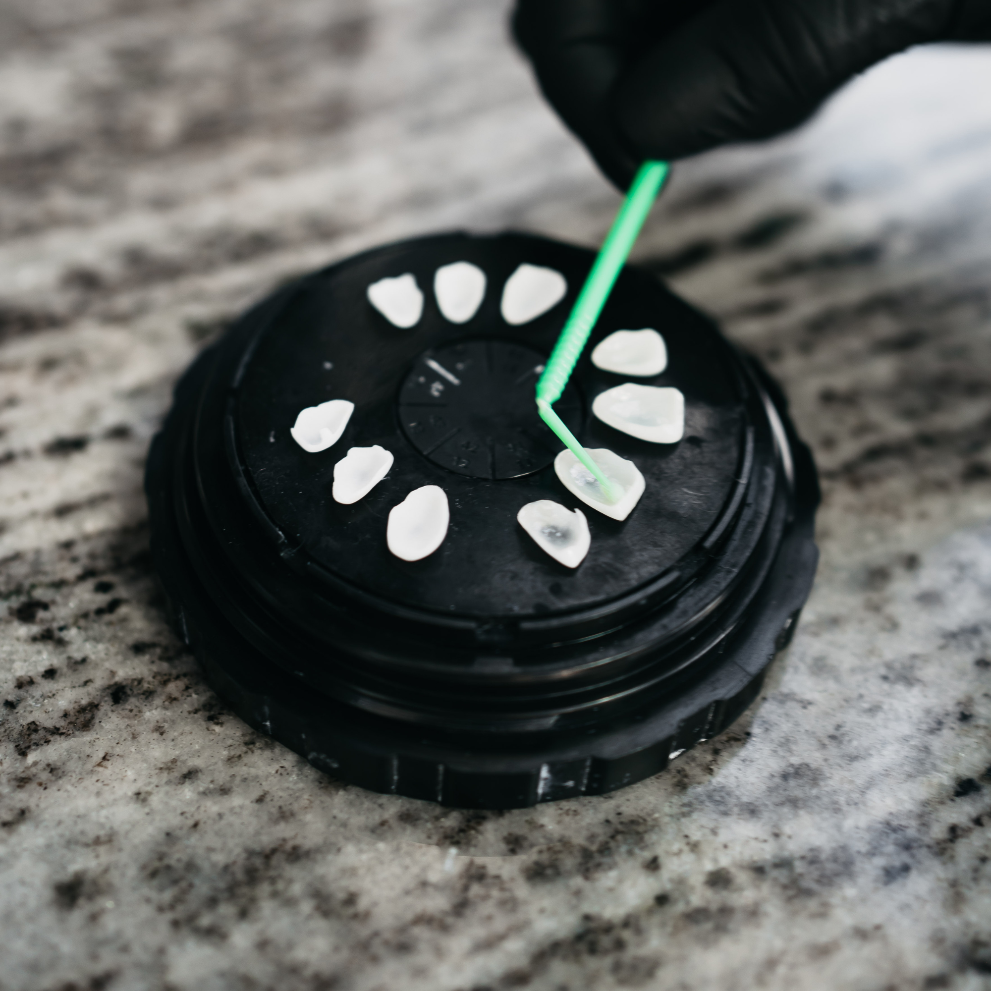 Facetas Dissilicato de Lítio